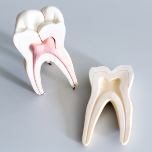 root canal treatment wyndham vale